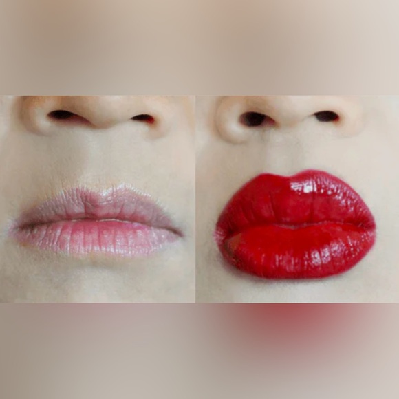 CANDYLIPZ Lip Plumper Device - Picture 5 of 7